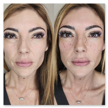 Before and after comparison of a client who received permanent makeup freckle enhancement at Studio 23 Esthetics, showing natural-looking cosmetic freckles designed to enhance facial features, add dimension, and create a soft, sun-kissed appearance with long-lasting results.