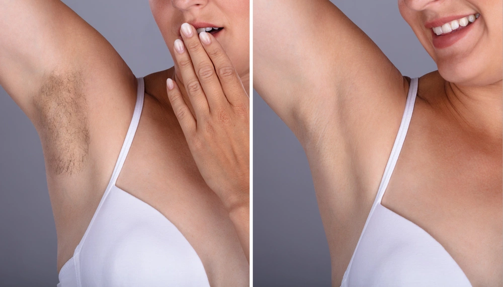 Smooth arms and underarms after waxing