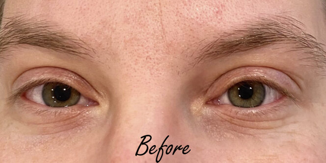 Close-up before image of natural eyelashes prior to receiving a professional eyelash enhancement service at Studio 23 Esthetics, showing the client’s original lash length, density, and shape for comparison purposes.